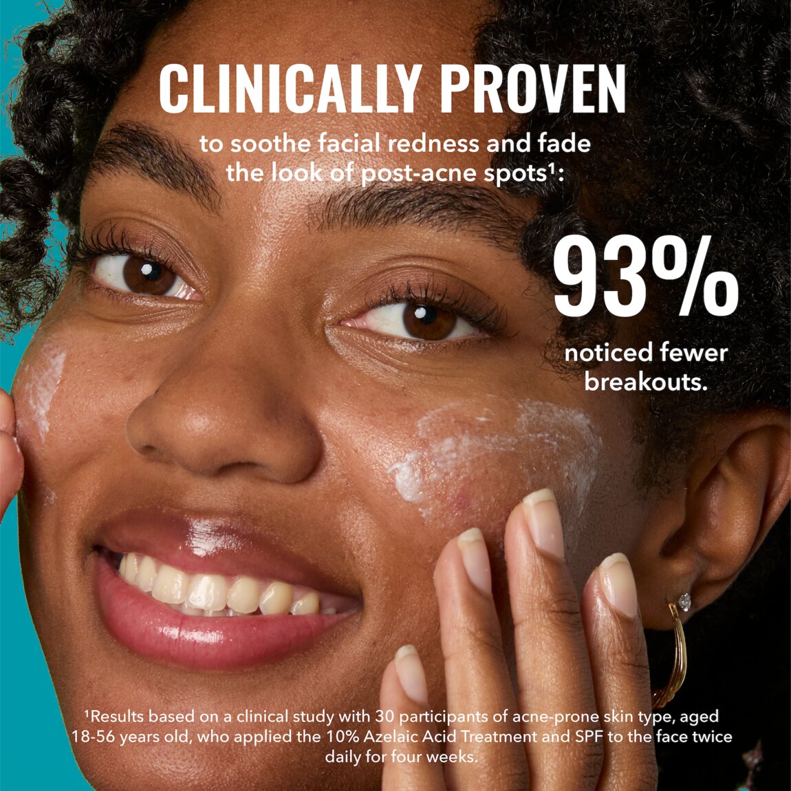 10-azelaic-acid-treatment-j1 zb_p.jpg