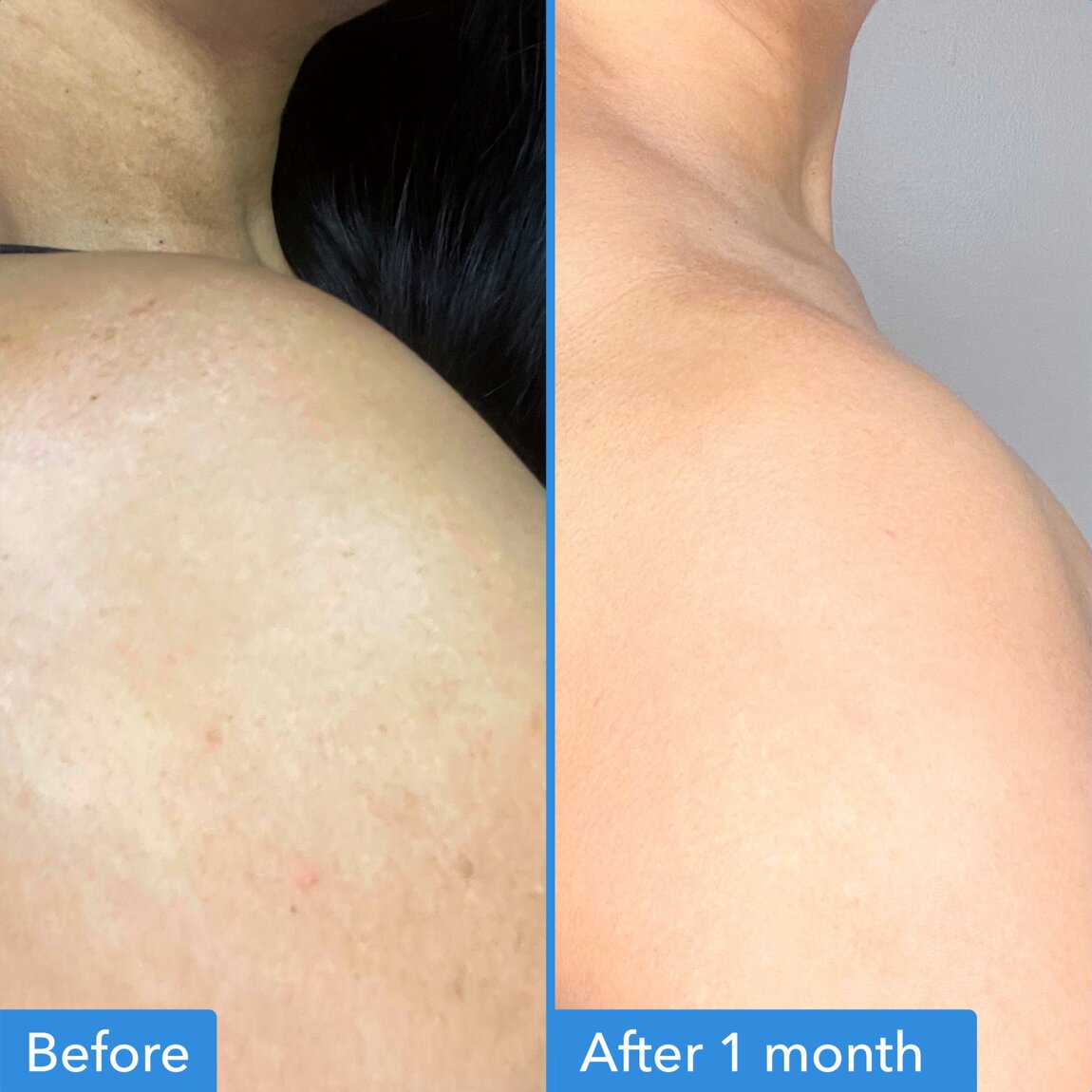 discoloration-correcting-body-treatment-l0 zb_p.jpg
